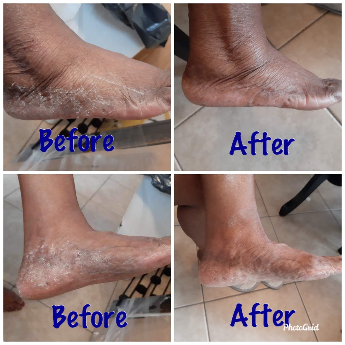 Peppermint Foot Scrub – Natural Exfoliator with Sugar & Essential Oils